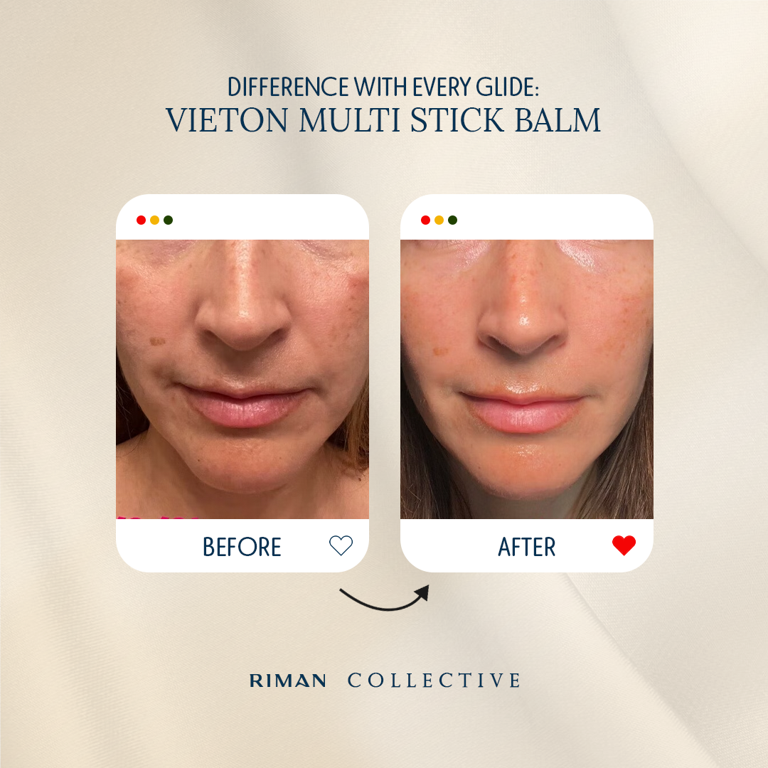 VIETON MULTI STICK BALM